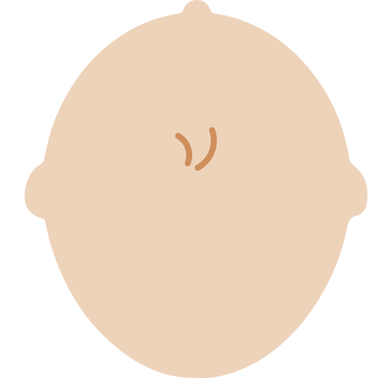 주상두증